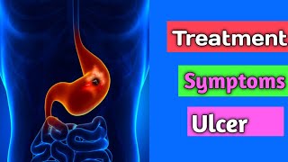 Ulcer  Peptic Ulcer  Treatment of Ulcer  Symptoms of Ulcer [upl. by Fermin]