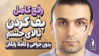 رفع پف پلک بالای چشم با حرکات و ماساژهای خانگی  Swollen eyelid treatment at home [upl. by Baudin]