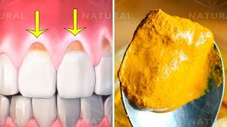 Why Turmeric is Fantastic for Oral Health and Hygiene [upl. by Katherin]