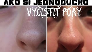 Jednoduchý návod ako si vyčistiť póry  DIY pore strip [upl. by Gupta]