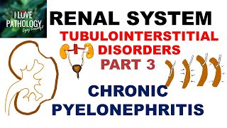 CHRONIC PYELONEPHRITIS  PATHOLOGY [upl. by Nnad]