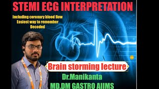 Stemi ecg interpretation  ecg localization of stemi  Mi ecg  neetpg fmge neet mbbs aiims [upl. by Raddatz679]