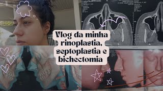 1º VLOG DA MINHA RINOPLASTIA SEPTOPLASTIA E BICHECTOMIA [upl. by Peony240]