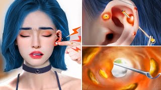 ASMR Piercing Cleaning Removing Pus from Piercing and Ear wax Removal  Tata New ASMR [upl. by Umberto]