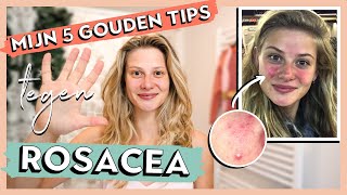 HOE IK VAN ROSACEA AF KWAM  Mijn 5 gouden tips amp behandelingen [upl. by Engen]