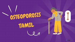 Osteoporosis in Tamil Definition Symptoms Causes Diagnosis and Management [upl. by Eduj]