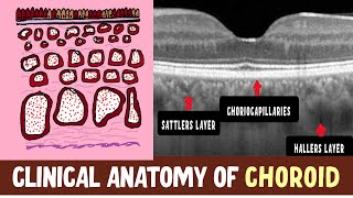 Anatomy Of Choroid  Hallers layer Sattlers layer Choriocapillaris and Clinical Nuggets [upl. by Akenaj]