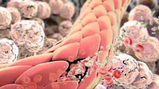 Inflammation Immune Response to Tissue Injury or Infection [upl. by Angy]