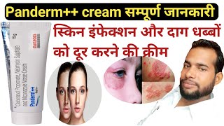 Panderm cream  Panderm cream  Panderm cream use in Hindi  pendram cream ke fayde [upl. by Lehctim]