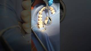 rubber dam use practice RubberDam DentalBasics DentalVlog GeorgiaDentistry DentalStudents [upl. by Nnaylloh450]