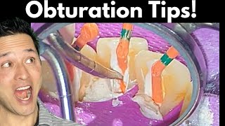 Root Canal Obturation Simplified  Tips to Save You Time [upl. by Graces]