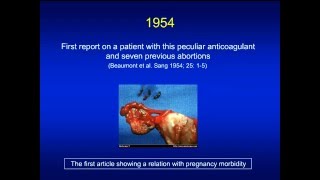 Antiphospholipid syndrome [upl. by Nohsram]