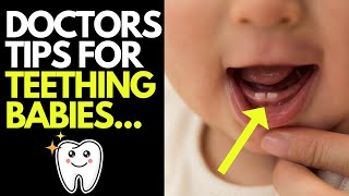 Doctor explains key things you need to know about BABY TEETHING  Symptoms amp tips for managing it [upl. by Lahsram]