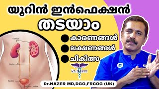 URINE INFECTION UTI MALAYALAM യൂറിൻ ഇൻഫെക്ഷൻ തടയാം  ലക്ഷണങ്ങൾ കാരണങ്ങൾ ചികിത്സ  Dr Nazer [upl. by Assert749]