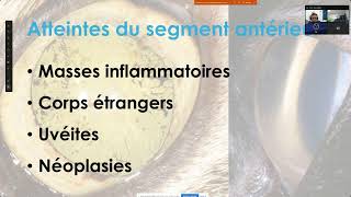 Webinaire FAS echographie en ophtalmologie pathologie [upl. by Yrac]