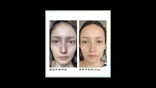 Real Face Yoga Results  Before And After beautytips shorts [upl. by Aronaele]