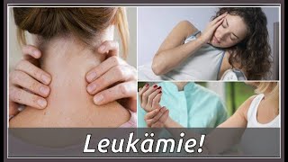 Das sind Symptome von Leukämie [upl. by Cathrin]