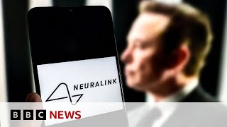 Elon Musk announces first Neuralink wireless brain chip implant in a human  BBC News [upl. by Leiruh]