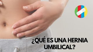 Hernia Umbilical [upl. by Martino951]