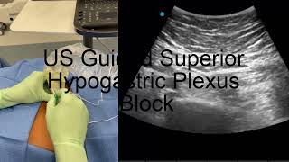 Ultrasound Guided Superior Hypogastric Plexus Block [upl. by Diann337]