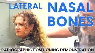 Lateral Nasal Bones Radiographic Positioning Demonstration [upl. by Ialohcin862]