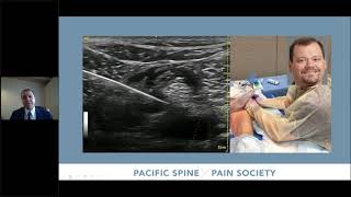 PSPS Training Webinar Series Session 1 Radiofrequency Techniques [upl. by Leyes]