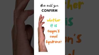 Confirmatory test for Guyon’s canal syndrome Froment’s test Ulnar tunnel syndrome shorts [upl. by Sew]