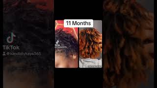 11 Months  Microloc Journey locs haircare growth [upl. by Annohsak]