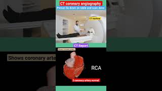 CT coronary angiography l heart coronaryartery shorts [upl. by Onileva]