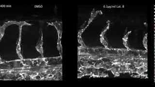 Dorsal migration of endothelial cells in zebrafish development [upl. by Erida36]