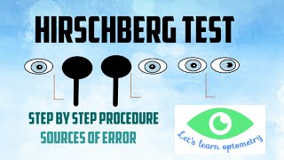 Fundoscopy Ophthalmoscopy  OSCE Guide  UKMLA  CPSA [upl. by Eesdnil]