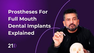 Prostheses For Full Mouth Dental Implants Explained [upl. by Napier]