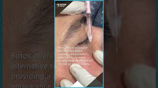 Botox for Forehead Wrinkles Before and After Transformations AWISH Clinic [upl. by Aihsakal24]