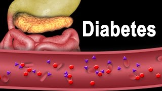 Diabetes Type 1 and Type 2 Animation [upl. by Joby317]