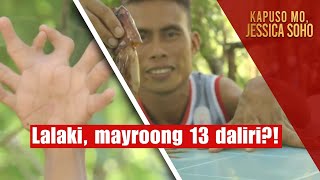 Lalaki mayroong 13 daliri  Kapuso Mo Jessica Soho [upl. by Dranreb]