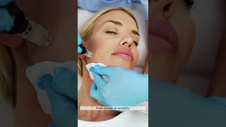 Microneedling Benefits Results and What to Expect Dermatologist Review [upl. by Auqenaj]