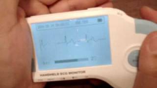 ECG Monitor  portable handheld [upl. by Noami915]