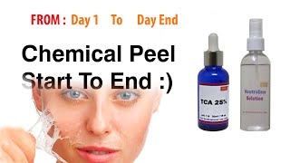 Chemical peel at Home Rejsol 25 Tca [upl. by Sheedy]