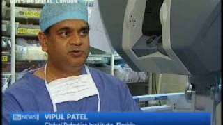 Robotic Prostatectomy Surgery with Dr Vipul Patel  Global Robotics Institute  AdventHealth [upl. by Hpotsirhc]