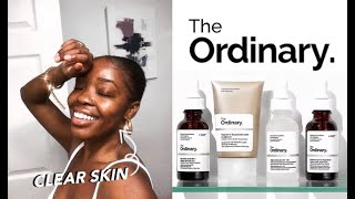 The Ordinary  3 Month SKIN UPDATE  Full Review  How I Got Rid of Hyperpigmentation  Dark Spots [upl. by Names]