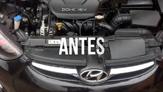 INTAKE HYUNDAI ELANTRA I35 [upl. by Latsyrk147]