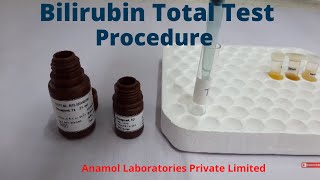 Bilirubin Test Procedure  Bilirubin Total Test [upl. by Enilrae187]