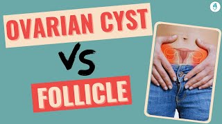 Everything about Ovarian Cysts and Follicle  Infertility Tips [upl. by Carolle]