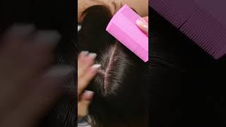 ASMR Relaxing LICE Check Removal and TREATMENT Real Person shorts short asmr [upl. by Vladimir895]