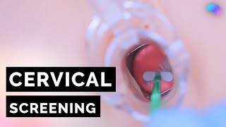 Cervical Screening Smear  HPV  OSCE Guide  UKMLA  CPSA [upl. by Cavit]