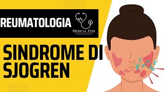 Sindrome di Sjögren  Generalità Fisiopatologia Diagnosi e Trattamento [upl. by Pinkham600]