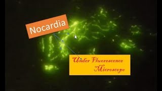 Nocardia under Flurescence Microscope Auramine–rhodamine stain of Nocardia [upl. by Lonyer]