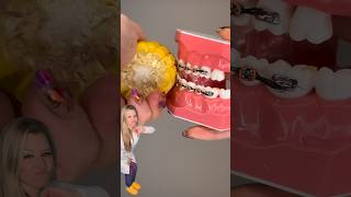 WHAT NOT TO DO IF YOU HAVE BRACES ON THANKSGIVING 🦃🦷🥲 Orthodontist Reacts Corn on the Cob shorts [upl. by Bozuwa520]