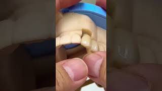 One implant dentist satisfying [upl. by Arihat]