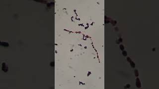 Streptococcus agalactiae in Gram staining of Culture Microscopy [upl. by Bigod628]